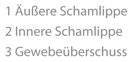 1. Äußere Schamlippe / 2 Innere Schamlippe / 3 Gewebeüberschuss